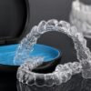 Елайнери Invisalign: сучасний спосіб вирівняти зуби без брекетів