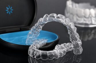 Елайнери Invisalign: сучасний спосіб вирівняти зуби без брекетів